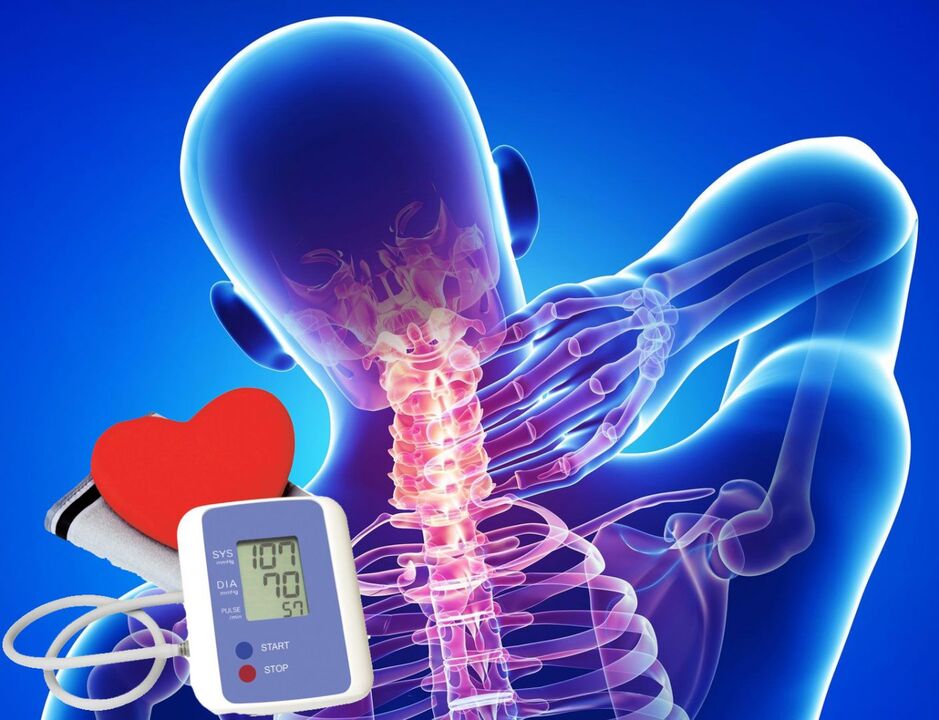 Asinsspiediena solīšana dzemdes kakla osteohondrozei