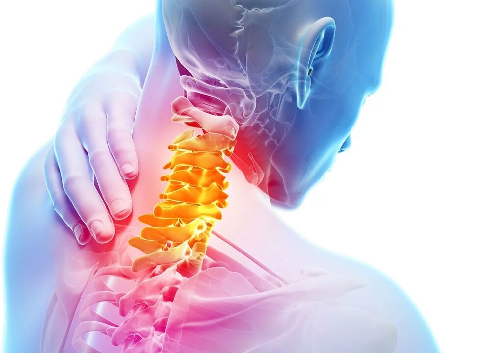 Dzemdes kakla osteohondroze