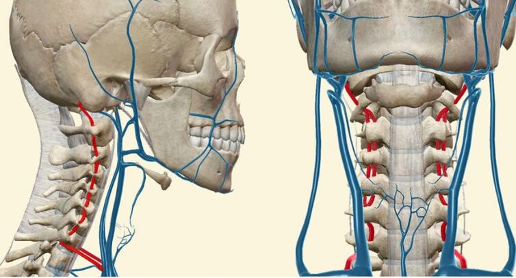 Asinsvadu sindroms osteohondrozes gadījumā