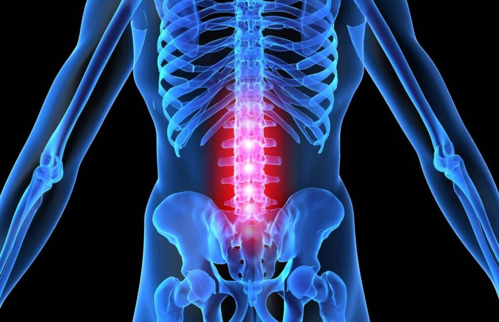 Jostas mugurkaula osteohondroze