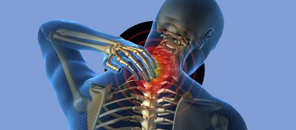 Mugurkaula kakla mugurkaula osteohondroze