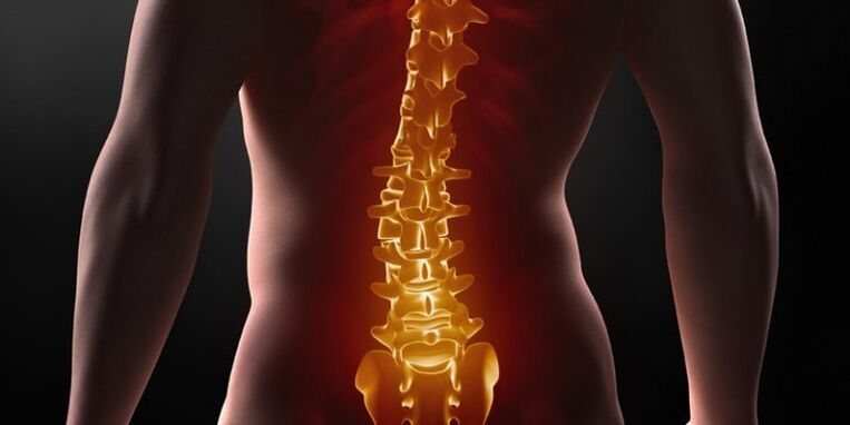 Sakrālā mugurkaula osteohondroze