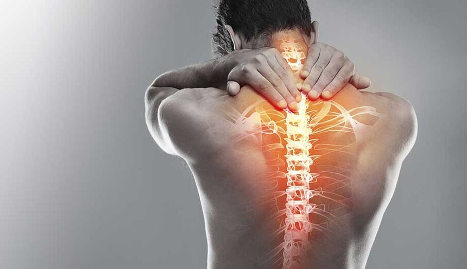 Sāpes mugurkaulā osteohondrozes dēļ